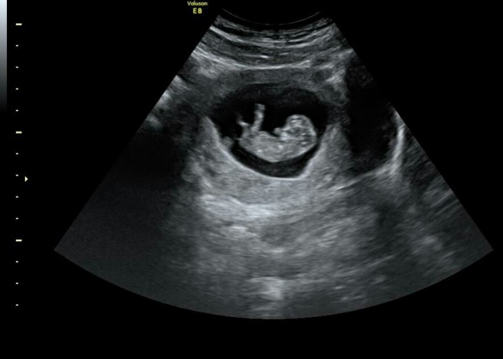 IMG_20170331_231008_018